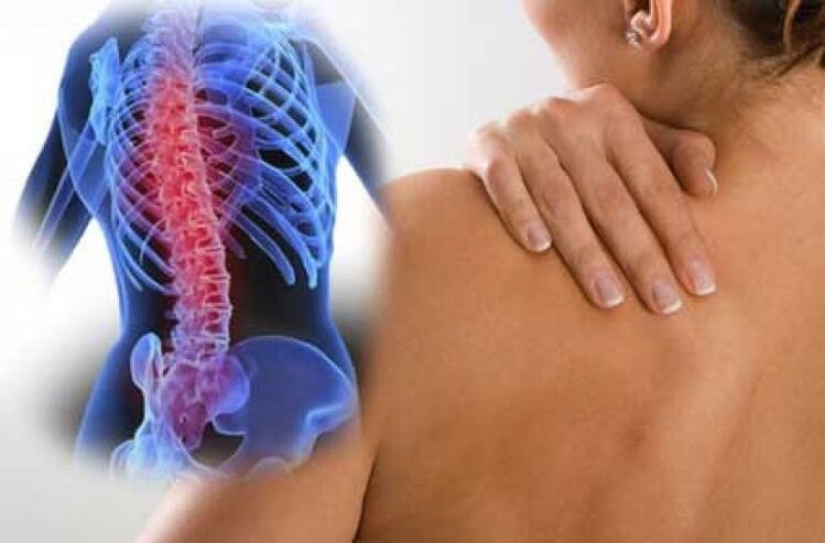 Osteoxondroz ilə ağrı bədənin uzaq hissələrinə yayıla bilər