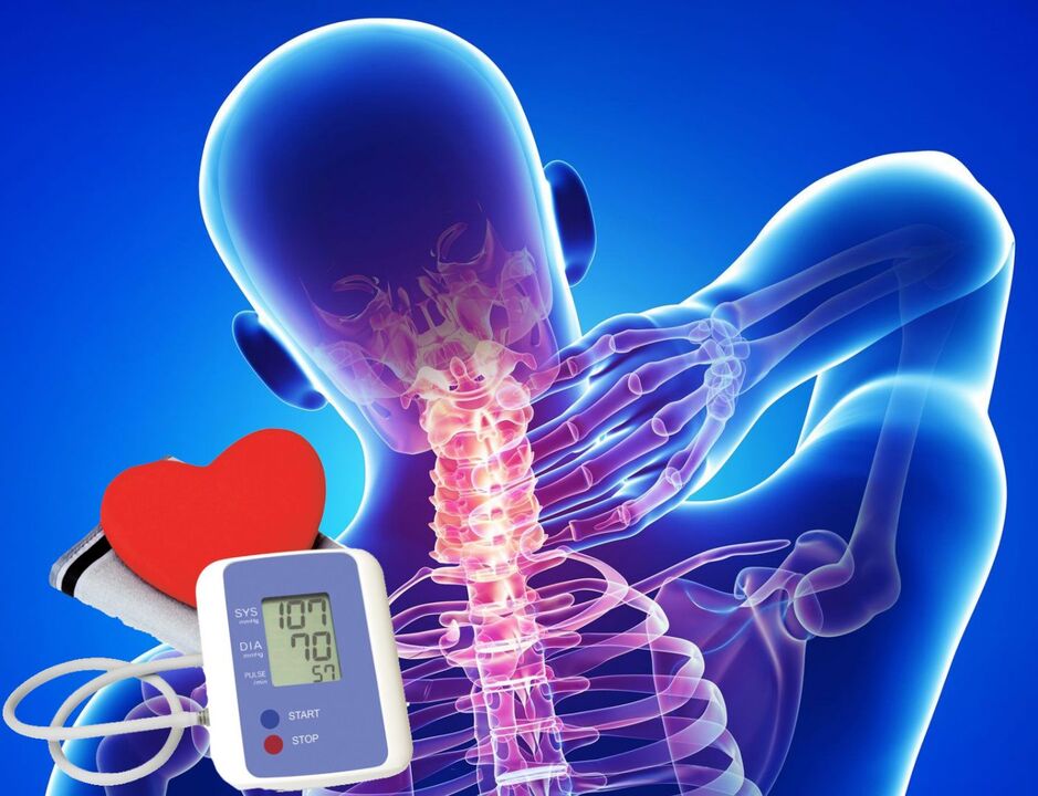 Servikal osteokondroz ilə qan təzyiqində sıçrayışlar