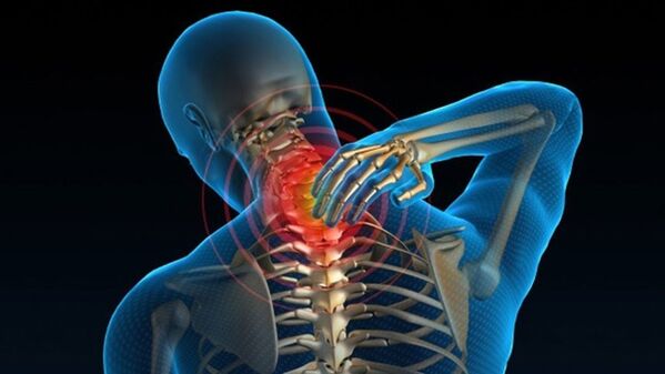 Boyun dönərkən ağrı vertebral servikal osteokondroz sindromunu göstərə bilər